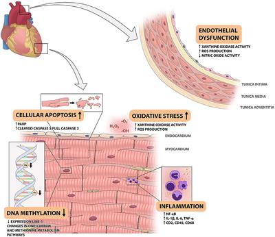 <mark class="highlighted">Myocardial Disease</mark> and Long-Distance Space Travel: Solving the Radiation Problem